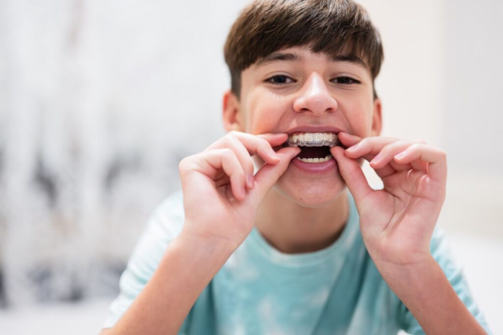 Invisalign for kids